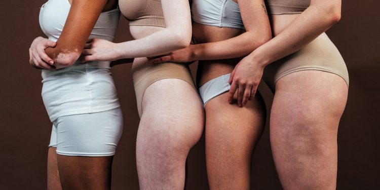 body shaming: che cos'è, come combatterlo, quando è un reato, come comportarsi