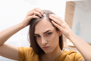 Alopecia femminile o androgenetica: cos’è, cause, come si presenta e cura