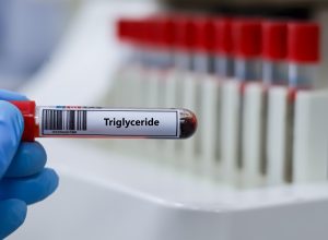 Trigliceridi alti: valori, sintomi, cause e cosa fare