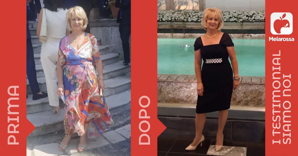 una donna prima e dopo la dieta
