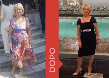 una donna prima e dopo la dieta