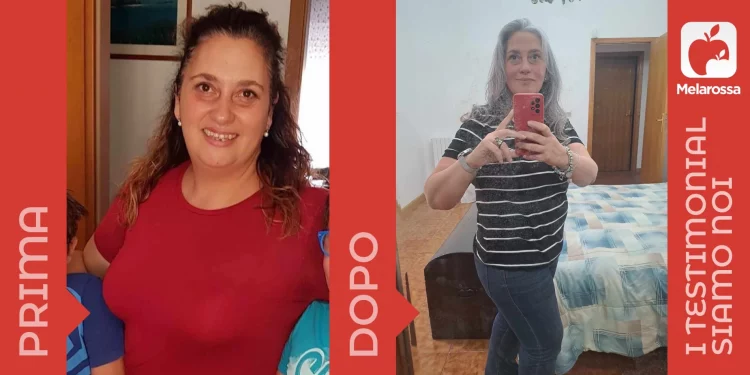 donna prima e dopo una dieta dimagrante