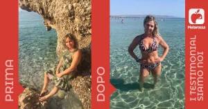 Simona -7 kg con Melarossa: “Dalla rassegnazione alla vittoria!”