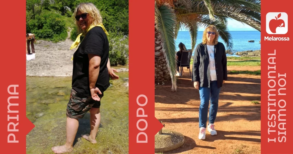 Testimonial 2 foto di donna prima e dopo la dieta Melarossa
