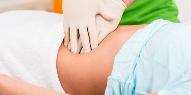 donna distesa su lettino che sta per eseguire una idrocolonterapia, mani di un medico che gli esegue un massaggio del colon