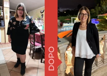 donna prima e dopo la dieta Melarossa