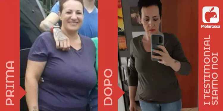 donna prima e dopo la dieta Melarossa grazie alla quale ha perso 20 kg
