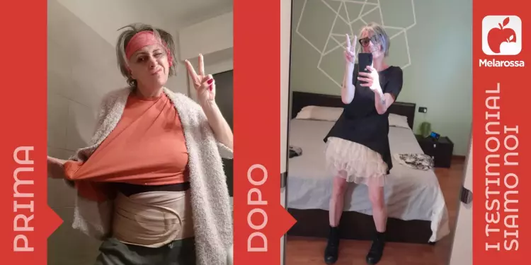 Si vede una donna fotografata prima e dopo la dieta dimagrante Melarossa