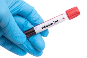 Potassio alto: sintomi, cause, valori e cosa fare